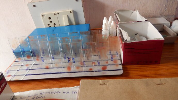 blood smears in a clinic